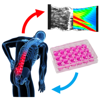 Illustration of a human biomechanical replacements